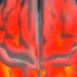 The Many Faces of Dementia